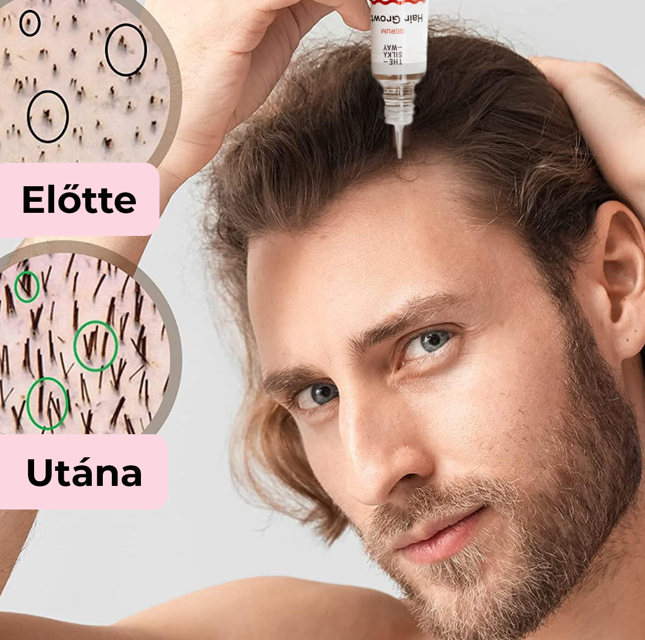 8 Hetes Hajnövekedést Serkentő Kúra