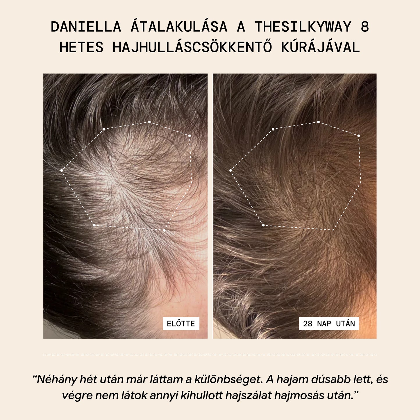 Hajhulláscsökkentő Thermo Maszk