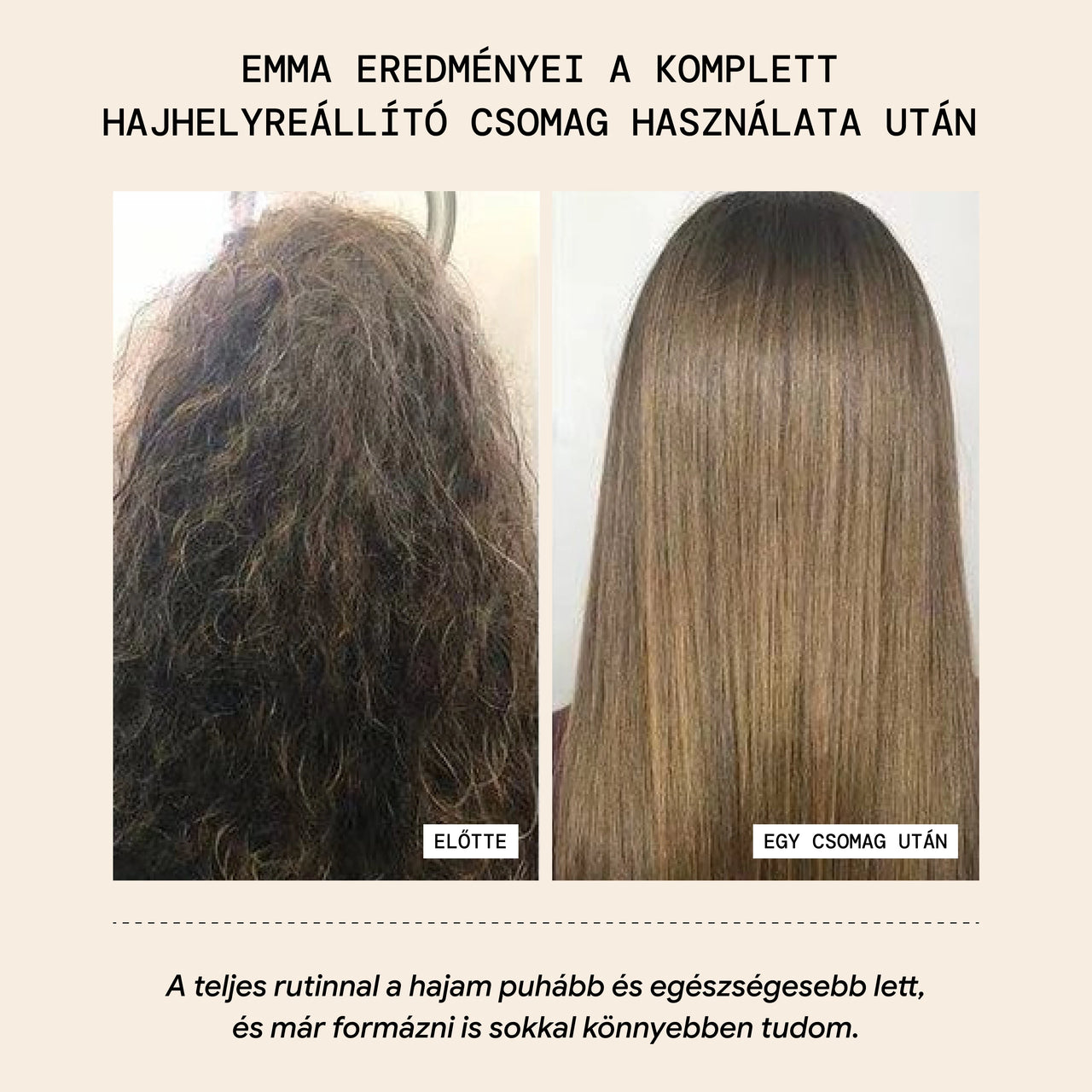 Komplett Hajhelyreállító Csomag